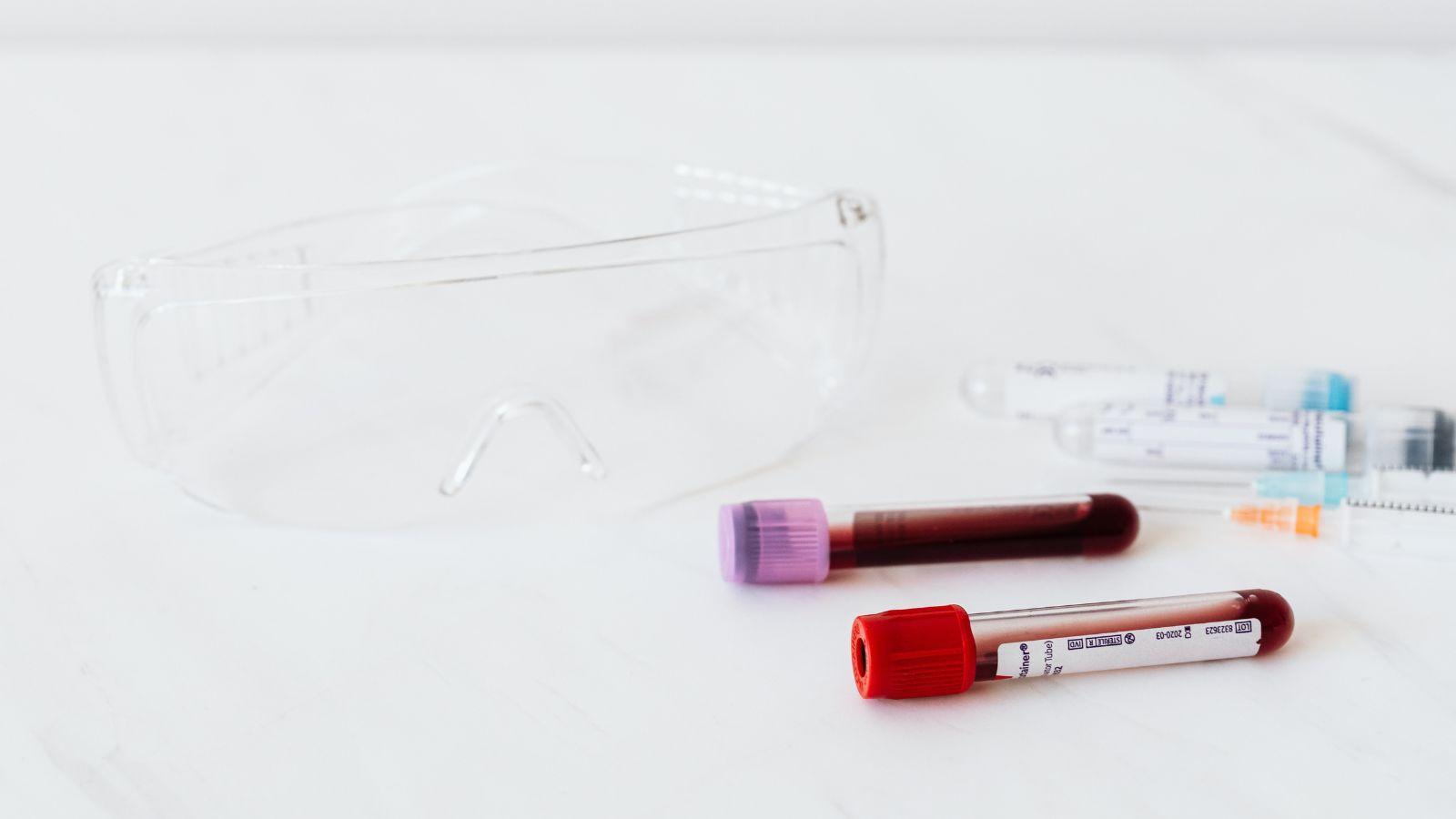 immunoglobulin therapy, specialty pharmacy coordination, immunoglobulin treatment outcomes, immune therapy solutions, custom immunoglobulin therapy, immunoglobulin infusion services, immune support therapies, immunoglobulin therapy providers, immunoglobulin care management